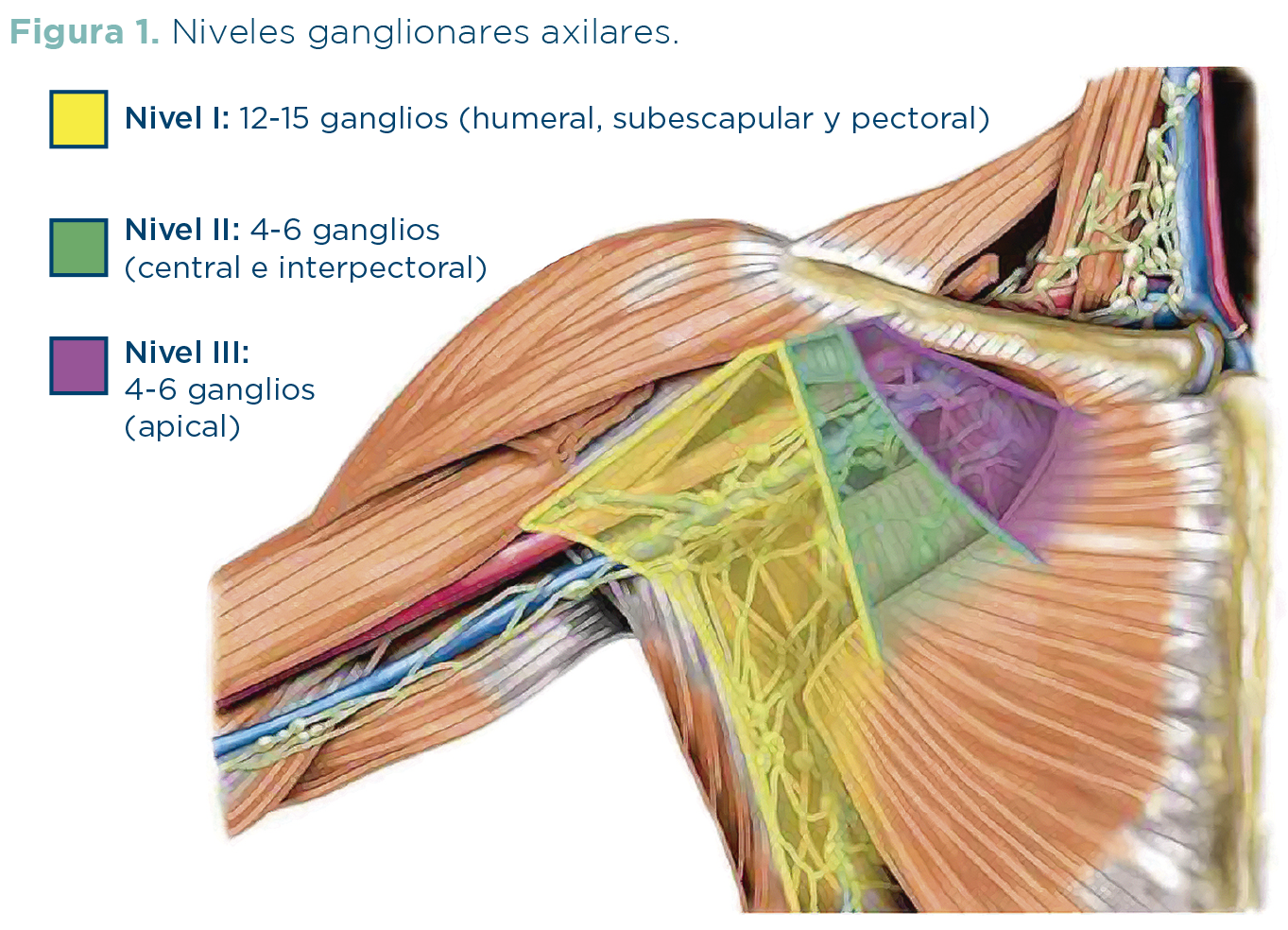 Figura 1. Niveles ganglionares axilares